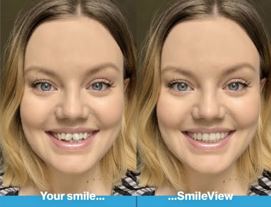 Smileview